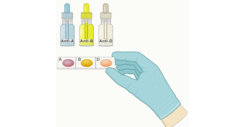 blood grouping