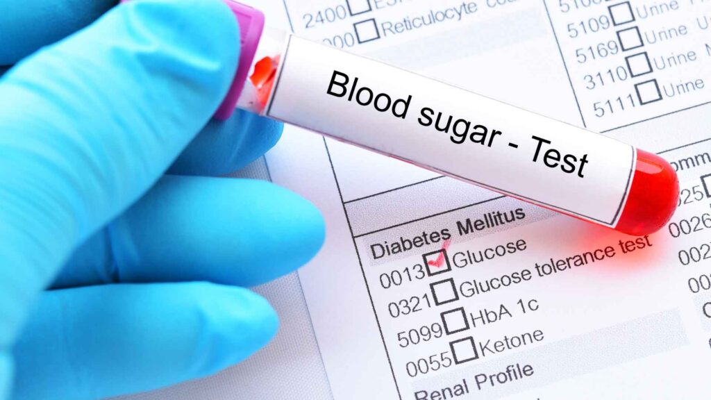 Lactose tolerance test