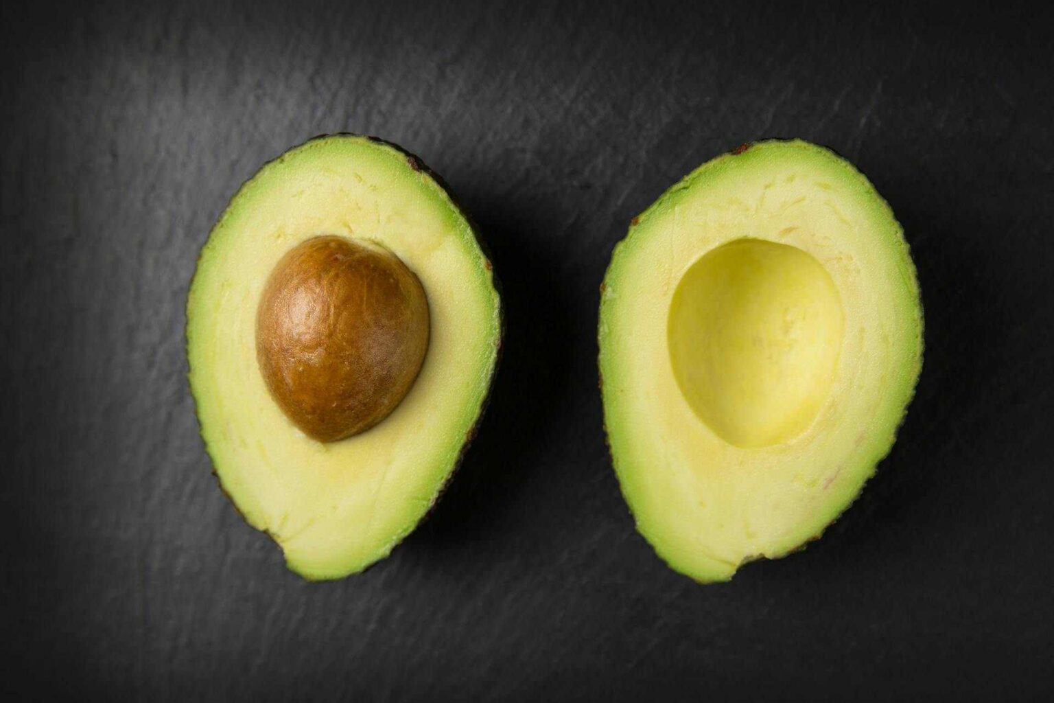 Health benefits of avocado